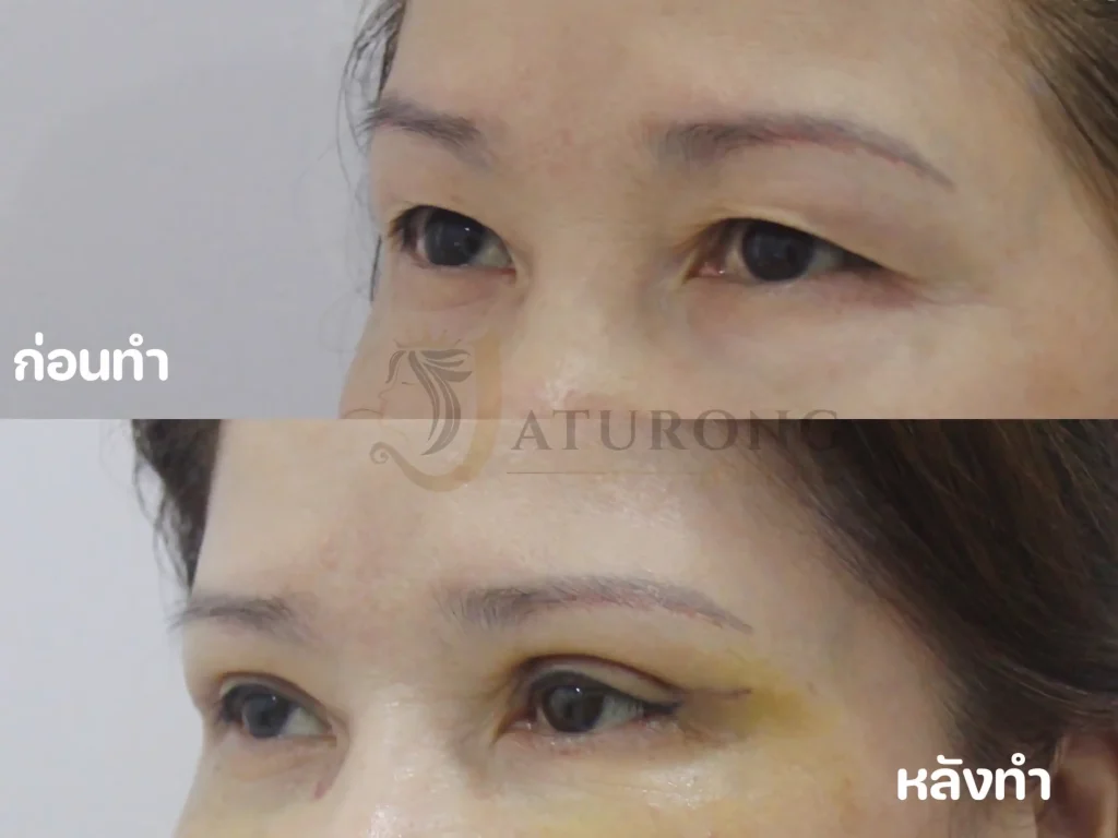 Jaturong ตาสองชั้น 13 (Web H)