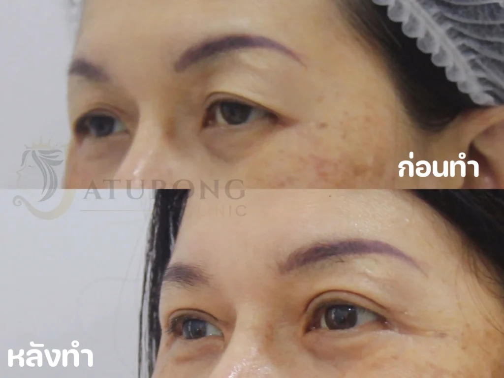 Jaturong ตาสองชั้น 16 (Web H)