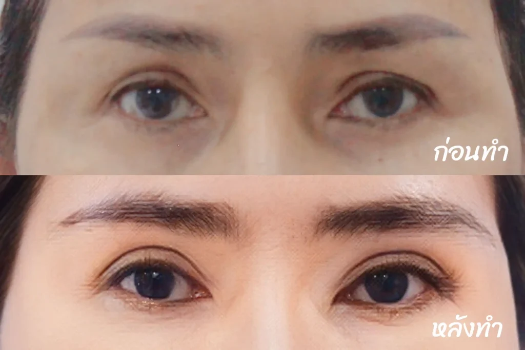 Jaturong ตาสองชั้น 9 (Web H)