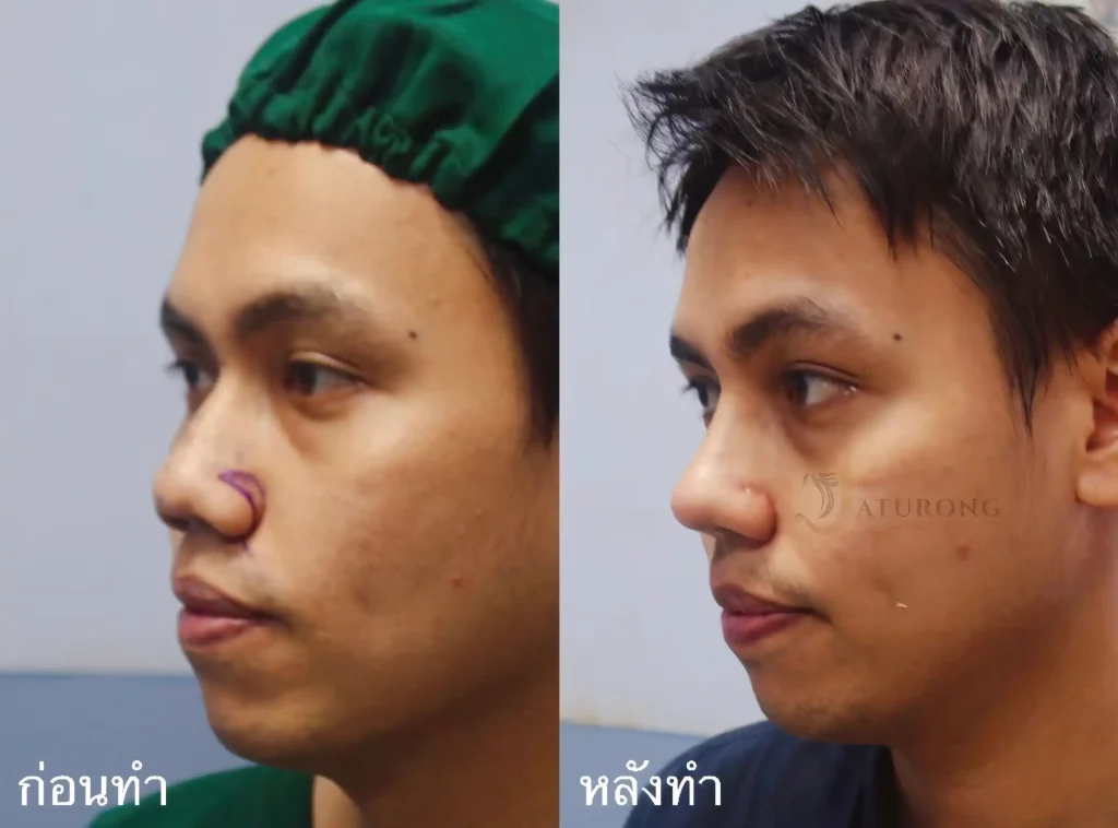 Jaturong ปีกยก 4 (Web H)