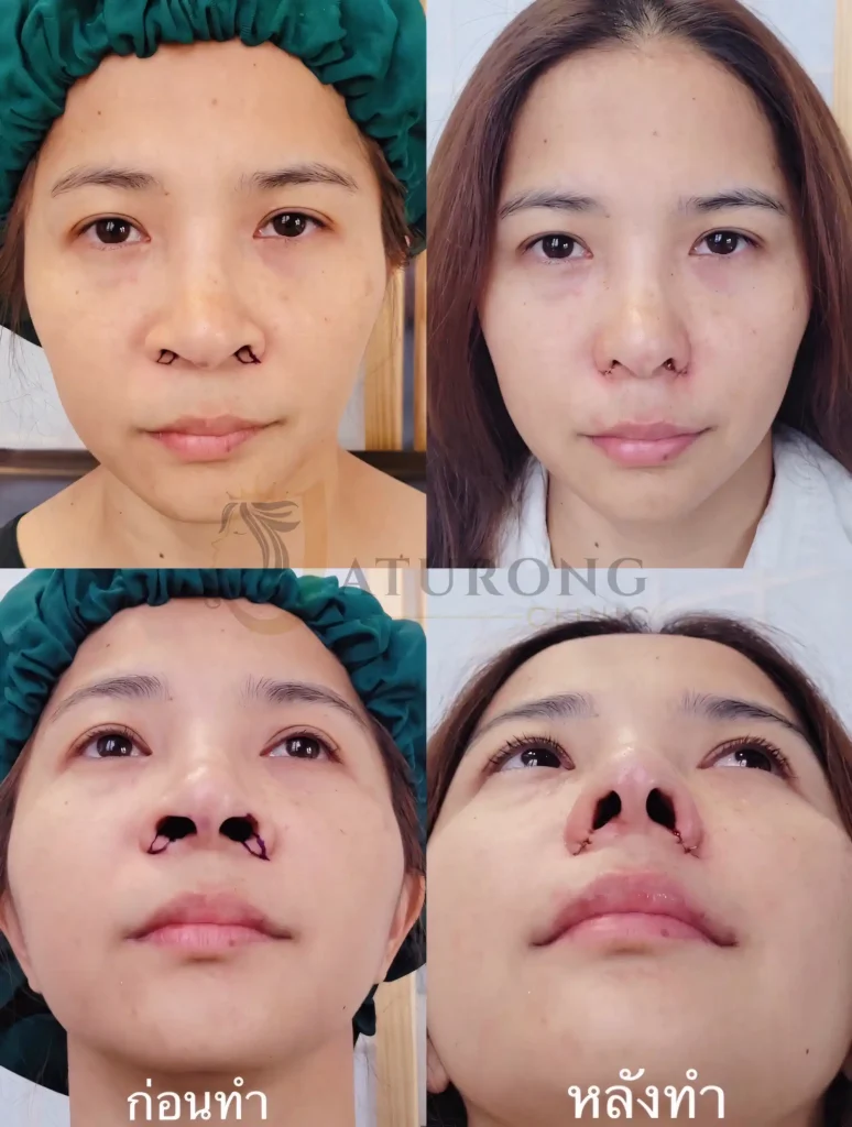 Jaturong ปีกหุบ 5 Web V