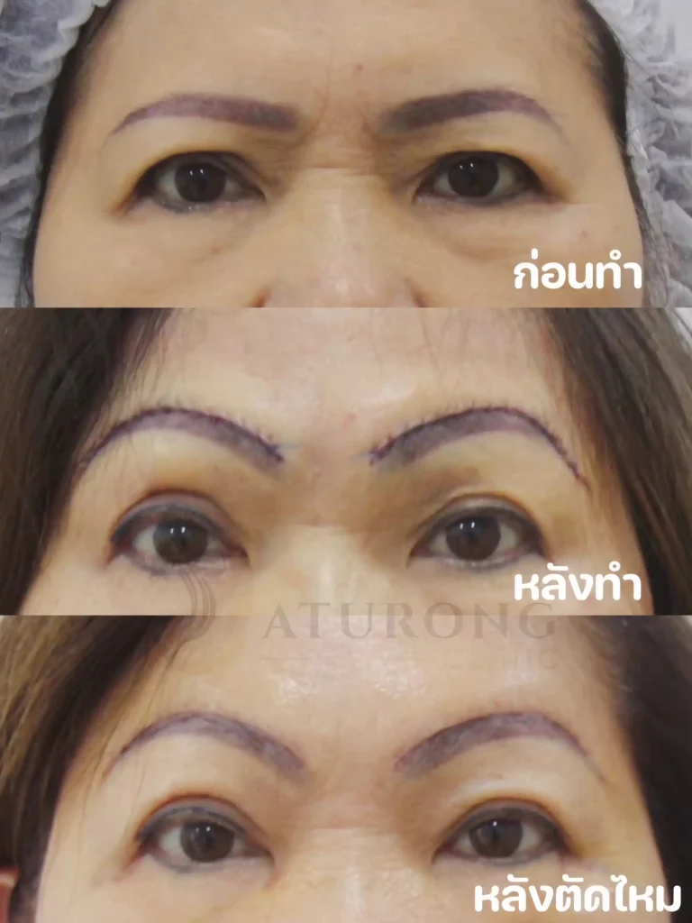 Jaturong ยกคิ้ว 2 Web V