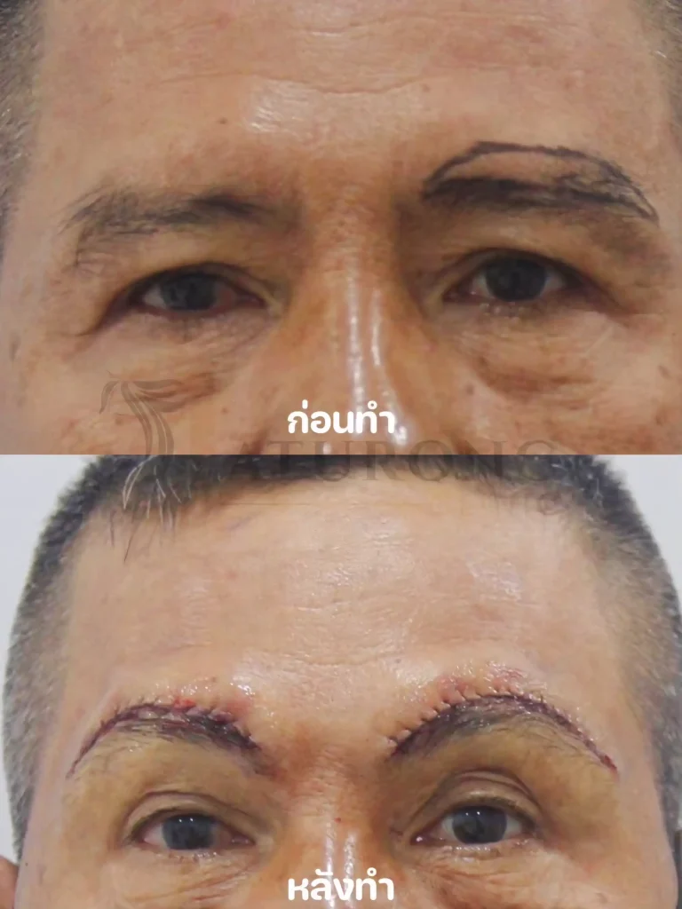 Jaturong ยกคิ้ว 3 Web V