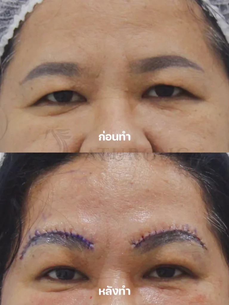 Jaturong ยกคิ้ว 4 Web V