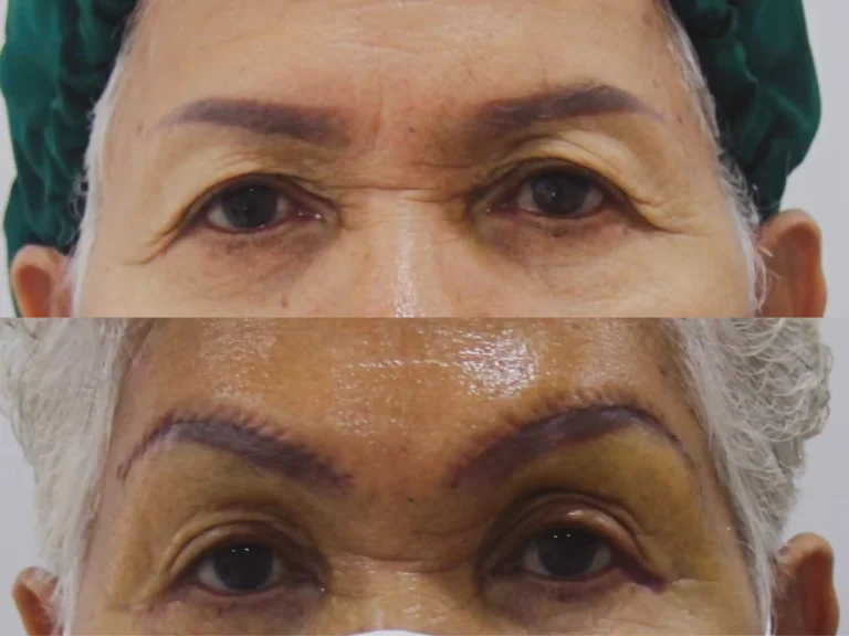 Jaturong ยกคิ้ว 5 Web H