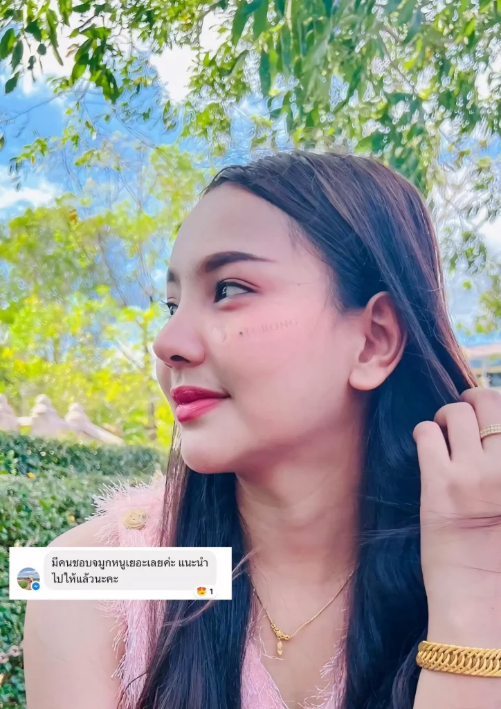 Jaturong เสริมจมูก 4 (Web V)